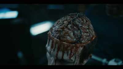 No indication that flesh
has been eaten away. - Origin