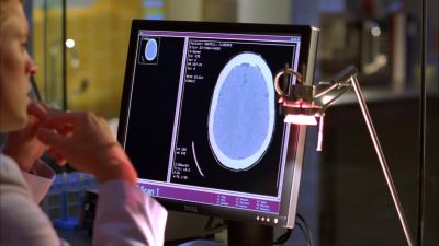 No lesions, no aneurysms. - House