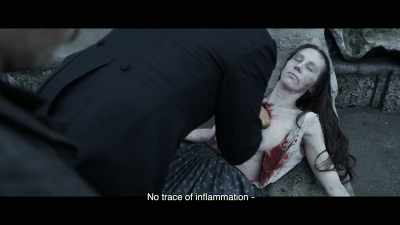 No trace of inflammation - - The Ninth