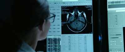 Note the negative mass effect
secondary to the encephalomalacia. - Flatliners