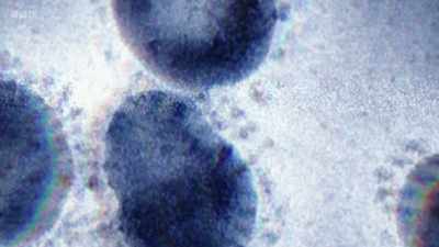 Now, for glass lenses,
this issue can be minimised. - Secrets of Size: Atoms to Supergalaxies