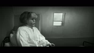 Now, it is only a physical problem. - The Elephant Man