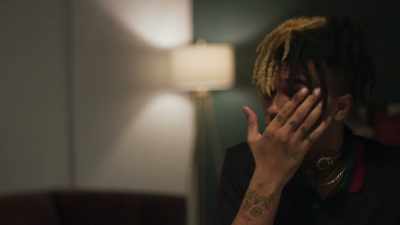 Now with the, the severe bruising, - Look At Me: XXXTENTACION
