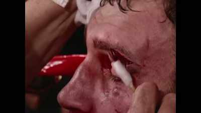 Oh, a horrible gash, - Klitschko: More Than a Fight