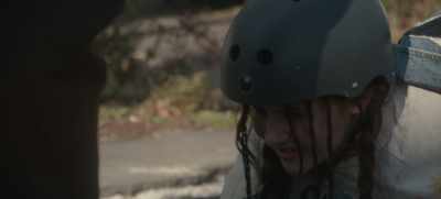 Oh, gnarly. It gonna
get back to normal? - Dear Edward