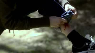 Oh! Look at that. That is not pretty. You ok? You should go. Take care of that. Really, it's nothing - The Vampire Diaries