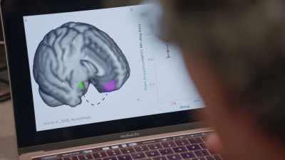 ONE IS IN THE AREA
OF THE PREFRONTAL CORTEX, - Why We Hate