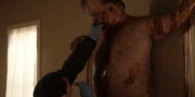 One laceration to the left cheek. - Reacher