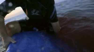 (painful scream) - Shark Attack Files