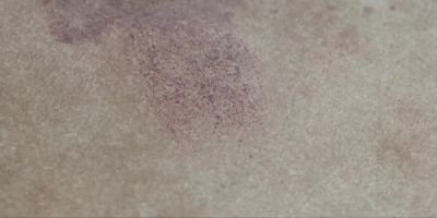 Partial shoeprint in the blood. - Silent Witness
