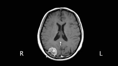 Particularly
interesting to me were - The Divided Brain