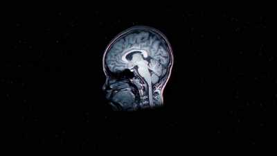 People also suggest
lack of oxygen to the brain. - Surviving Death