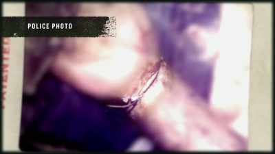 Pete: The body was thought
to believe - Buried In The Backyard