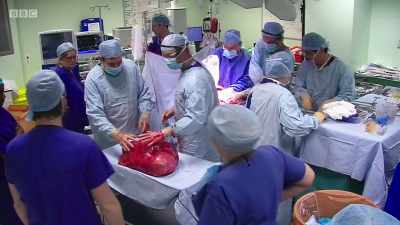 Phew! - Surgeons: At the Edge of Life