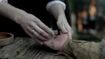 Physicians being few and
far between in these parts - Outlander