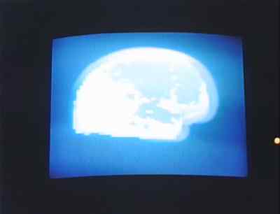 Picking up a nice healthy signal from your brain. - The Lathe of Heaven