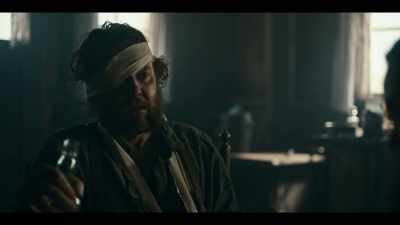Poor Norm? What about me?
Nearly lost my eye. - Billy the Kid