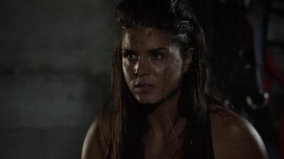 Pupils are
unresponsive. - The 100