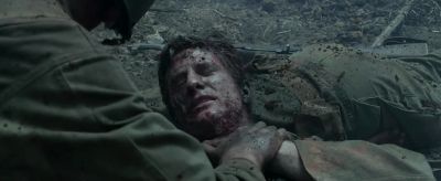 Put your hand on it.
Keep pressure on it. - Hacksaw Ridge