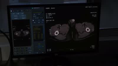 Quinn doesn't have appendicitis. - The Good Doctor