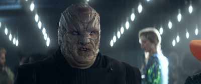 Rare to find one
with so many implants - Star Trek: Picard