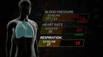Respiratory rate is at 18. - Kings of Pain