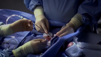 Retract more here. - Grey's Anatomy