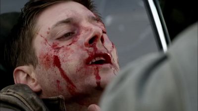 Sammy. - Supernatural