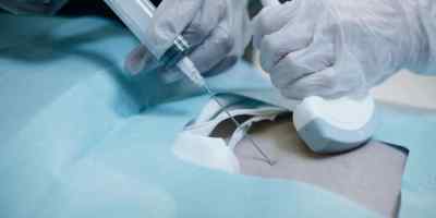 SATS are falling. - Transplant