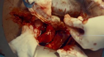 Scissors. - Saving Hope