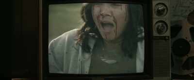 [ Screams] - Bloody Axe Wound