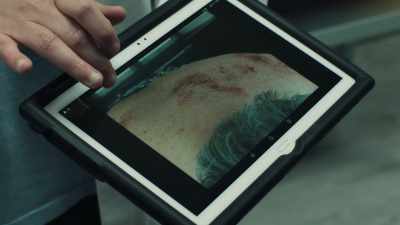 See this discoloration across
his shoulders and upper back? - The Chelsea Detective