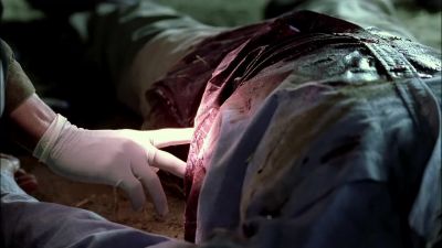 See the lividity? - CSI: Crime Scene Investigation
