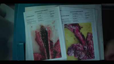Sergeant Durborrow's autopsy,
it's been falsified. - Tidelands