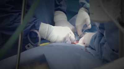 Several days ago,
eebi had fairly major surgery. - Secrets of the Zoo