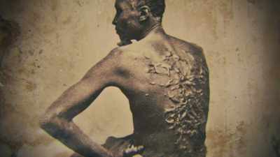 - Severe whipping
with a bullwhip, - Abraham Lincoln