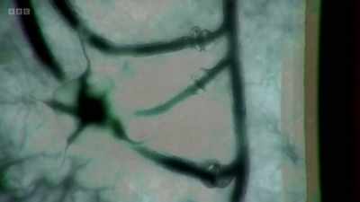 Shape-shifting cells called
microglia are the brain's - The Human Body: Secrets of Your Life Revealed