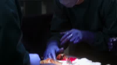 SHAUN: The aorta isn'’t kinked. - The Good Doctor