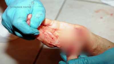 She had a thumb
that was almost severed. - Floribama Murders