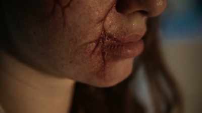 She came to our facility
with every bone in her body broken. - Haunted Hospitals
