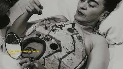 She had many surgical interventions - Frida