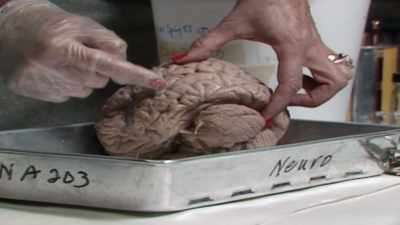 She was showing that there was
a kind of brain cell - The Man Who Stole Einstein's Brain
