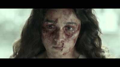 She's got 15 stitches on her stomach - Gangubai Kathiawadi
