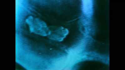 -Sickle cell's
a really interesting, - Human Nature