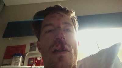 [sighs] - Shaun White: The Last Run