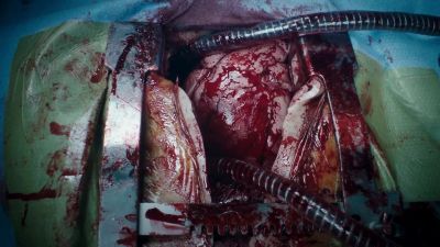 Sinus rhythm. - The Resident