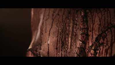 Six months old. Mitral valve. - Grotesquerie