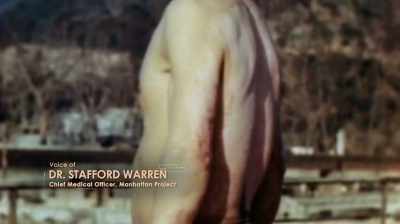 Skin burns and things
like that were common
to all warfare. - Hiroshima and Nagasaki: 75 Years Later