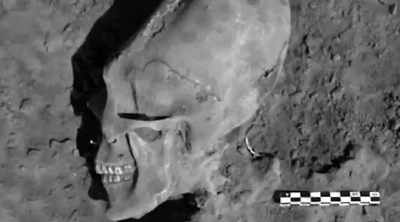 Skull elongation is
this strange activity - Alien Worlds: Giants and Hybrids
