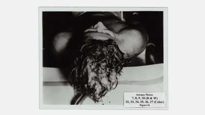 So that any evidence
that would show a front shot, - JFK: What The Doctors Saw